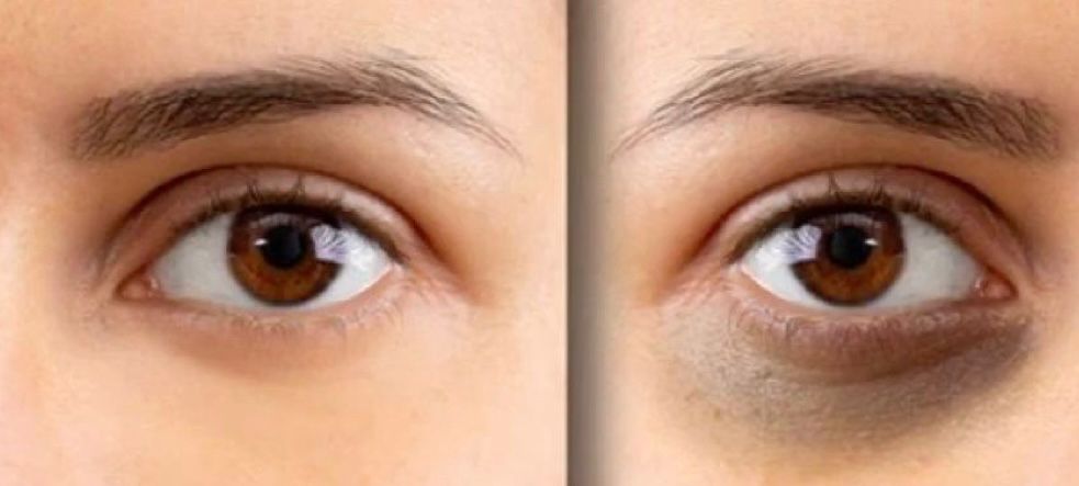 SPARKGLOW EYE CREAM